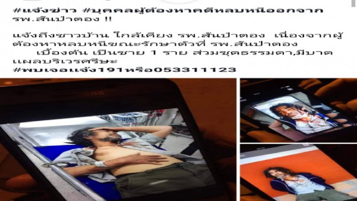 หนุ่มลักทรัพย์ พลาดตกบันไดซี่โครงหัก หนุ่มลักทรัพย์ พลาดตกบันไดซี่โครงหัก