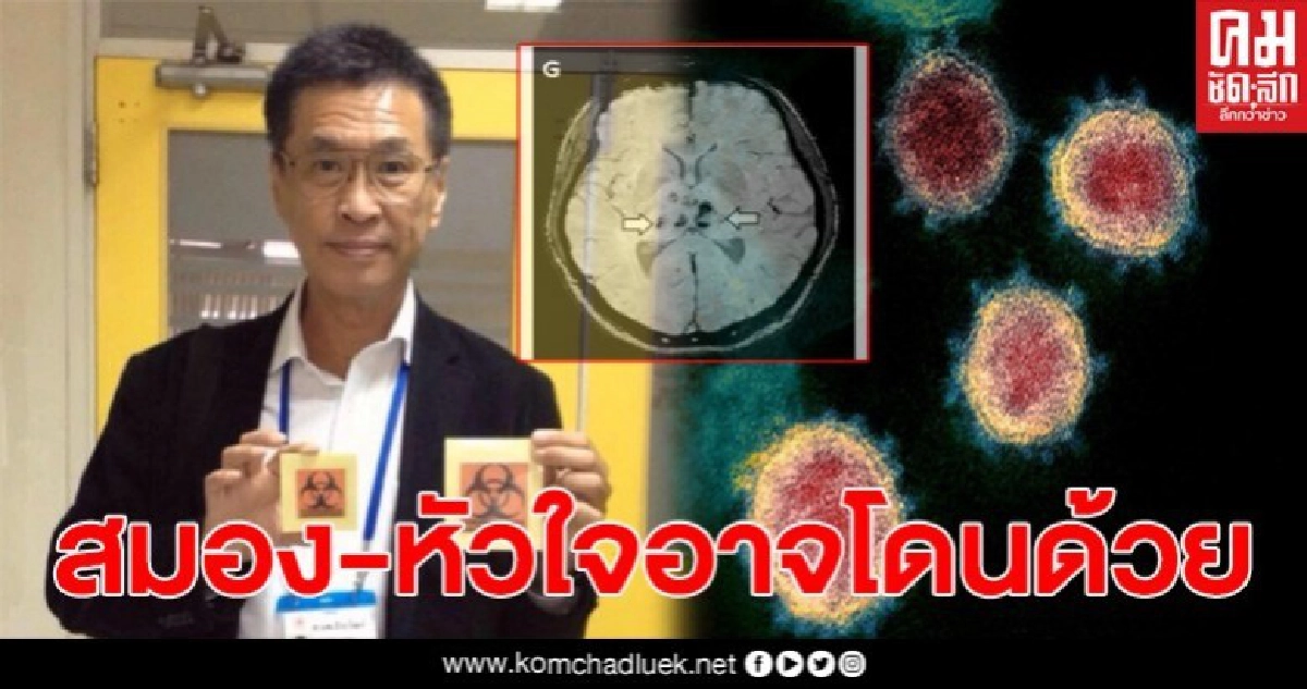 หมอธีระวัฒน์เผยโควิด19 ไม่ได้ทำลายปอดอย่างเดียว อาจมีผลต่อสมอง-หัวใจด้วย หมอธีระวัฒน์เผยโควิด19 ไม่ได้ทำลายปอดอย่างเดียว อาจมีผลต่อสมอง-หัวใจด้วย