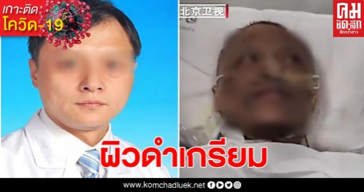 เปิดภาพ แพทย์อู่ฮั่นผิวเปลี่ยนสี หลังหายโควิด-19
