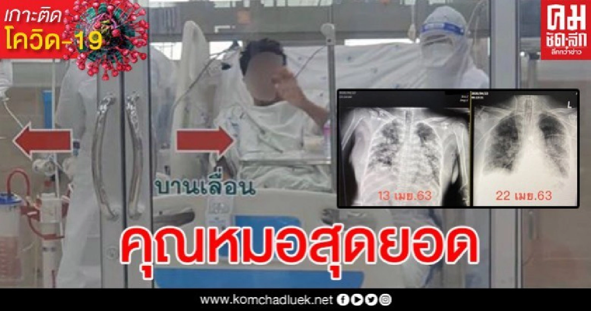 ผู้ป่วยโควิด-19 ขอนแก่น ฟื้นจากภาวะวิกฤติเฉียดตายจากปอดติดเชื้อรุนแรง
