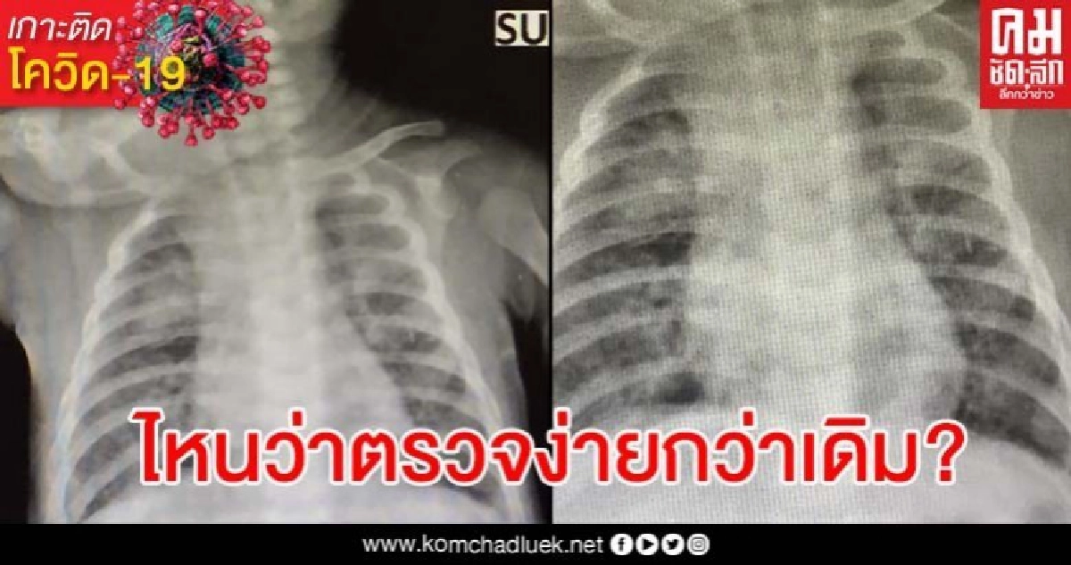 หมอบ่นอุบ ทารกวัย 2 เดือนเข้าข่ายติดโควิด ขอส่งตรวจแต่ถูกปฏิเสธ หมอบ่นอุบ ทารกวัย 2 เดือนเข้าข่ายติดโควิด ขอส่งตรวจแต่ถูกปฏิเสธ