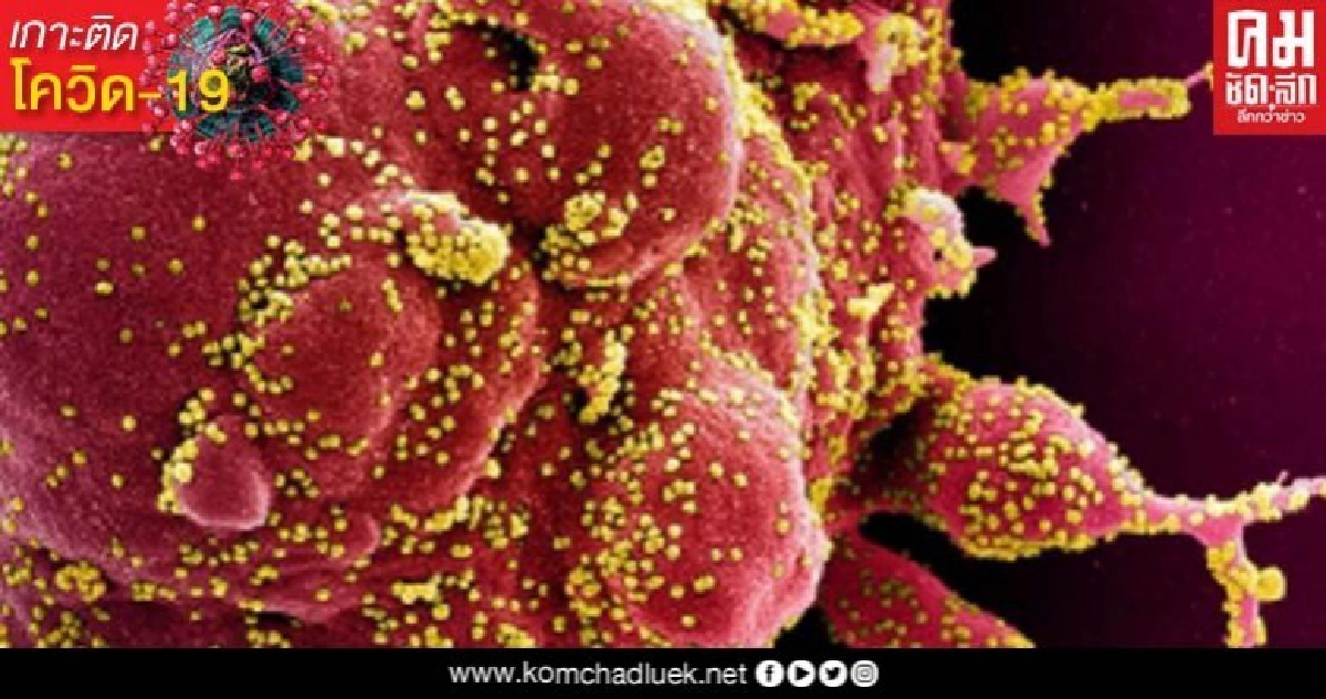 เผยยาต้านโควิด-19 ตัวใหม่ ลดอัตราการตาย หายกลับบ้านเร็วกว่า