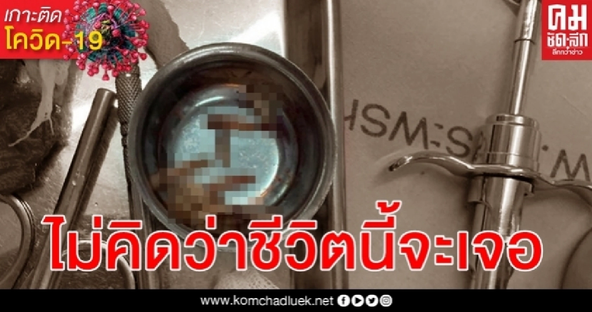 หมอเยี่ยมคนไข้นอนติดเตียงเหงือกบวมมากด้วยสาเหตุนี้ถึงกับภาพติดตา หมอเยี่ยมคนไข้นอนติดเตียงเหงือกบวมมากด้วยสาเหตุนี้ถึงกับภาพติดตา