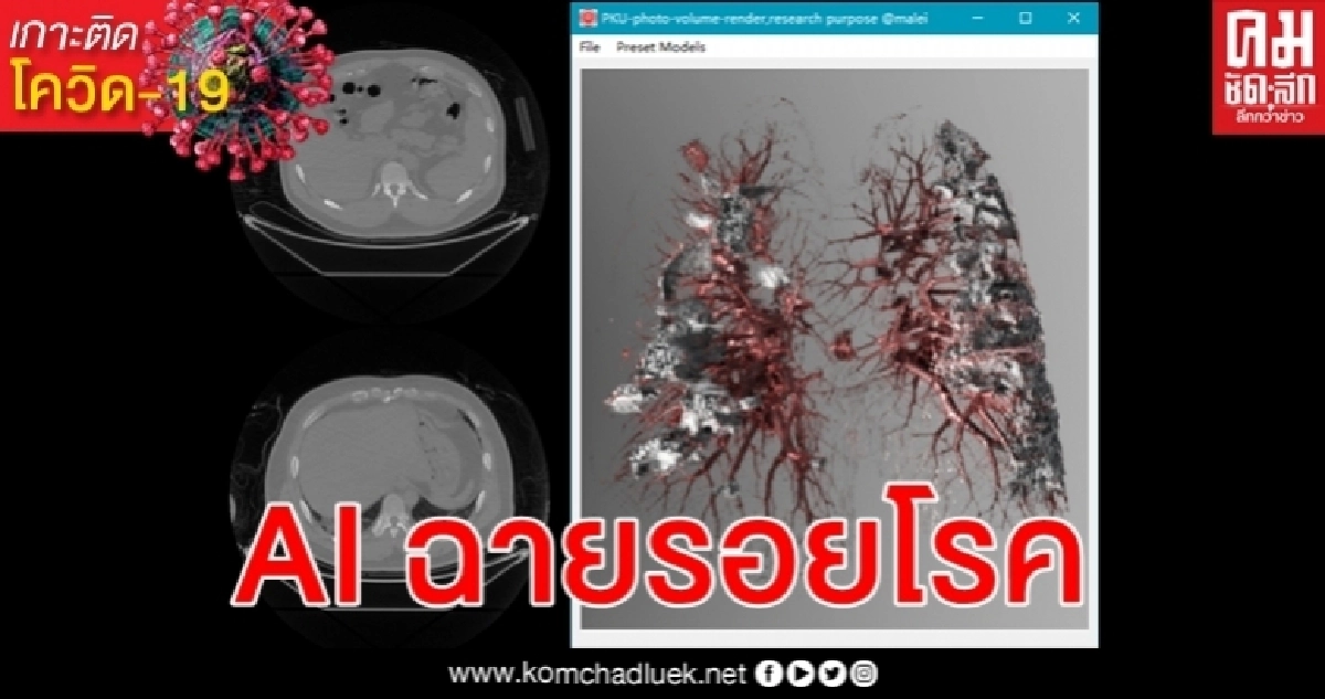 AI ฉายรอยโรคโควิด-19 นักวิจัยจีนพัฒนาสร้างภาพปอดสมจริงชัดเจนเข้าใจง่าย AI ฉายรอยโรคโควิด-19 นักวิจัยจีนพัฒนาสร้างภาพปอดสมจริงชัดเจนเข้าใจง่าย