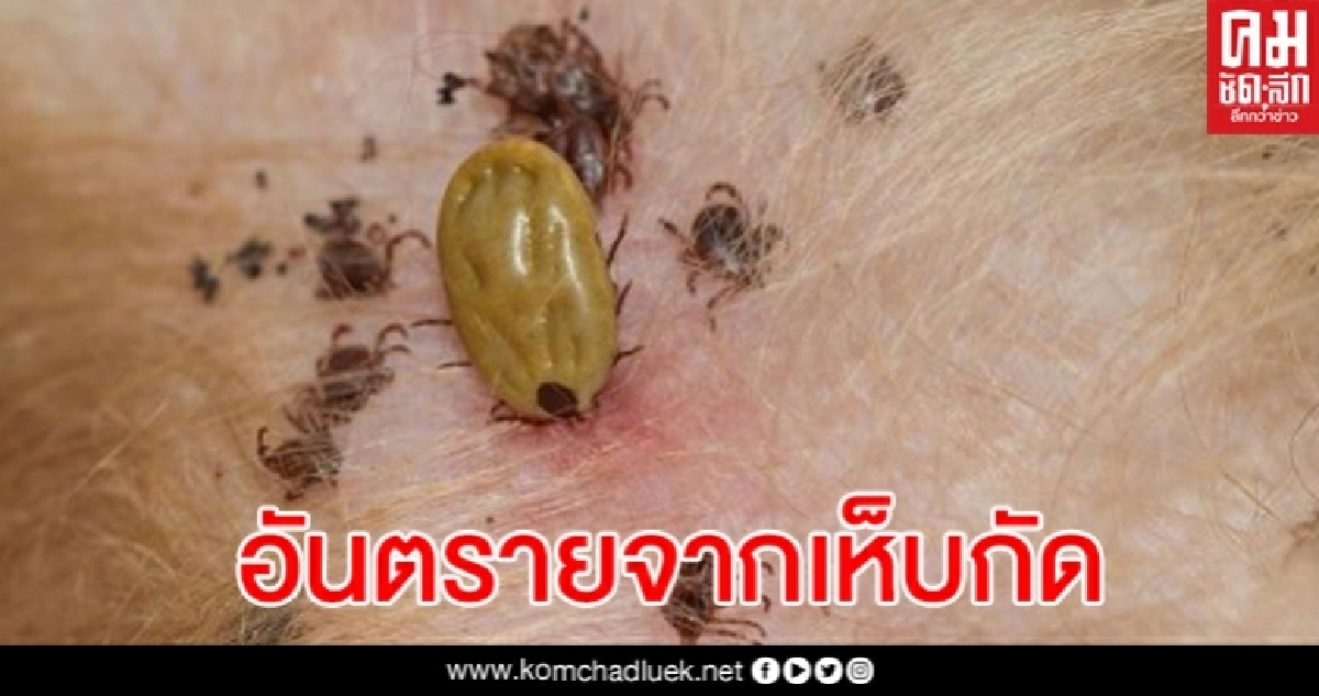 เตือน เห็บกัดอันตรายถึงขั้นเป็นอัมพาตชั่วคราวได้ เตือน เห็บกัดอันตรายถึงขั้นเป็นอัมพาตชั่วคราวได้