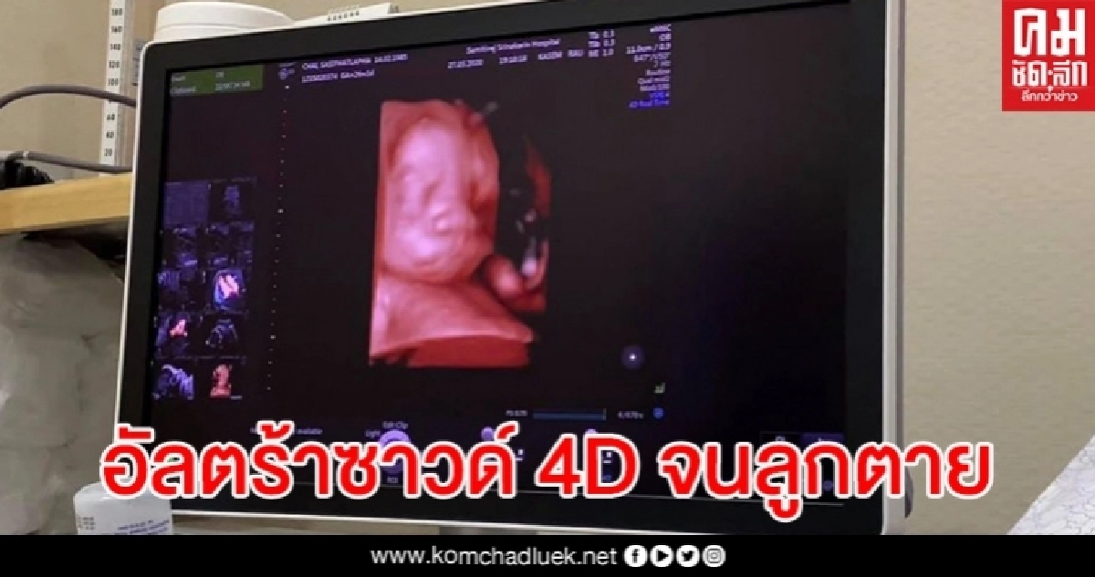 พ่อคาใจ รพ.เอกชนชื่อดัง อัลตราซาวน์ 4D หมอกดท้องแม่จนลูกในท้องตาย พ่อคาใจ รพ.เอกชนชื่อดัง อัลตราซาวน์ 4D หมอกดท้องแม่จนลูกในท้องตาย