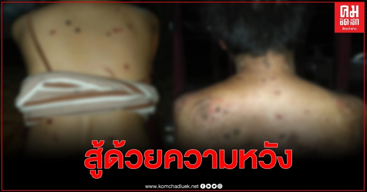สาวแชร์ประสบการณ์ป่วยเป็นโรคเดียวกับวินัยไกรบุตร ชาวเน็ตแห่ให้กำลังใจ สาวแชร์ประสบการณ์ป่วยเป็นโรคเดียวกับวินัยไกรบุตร ชาวเน็ตแห่ให้กำลังใจ