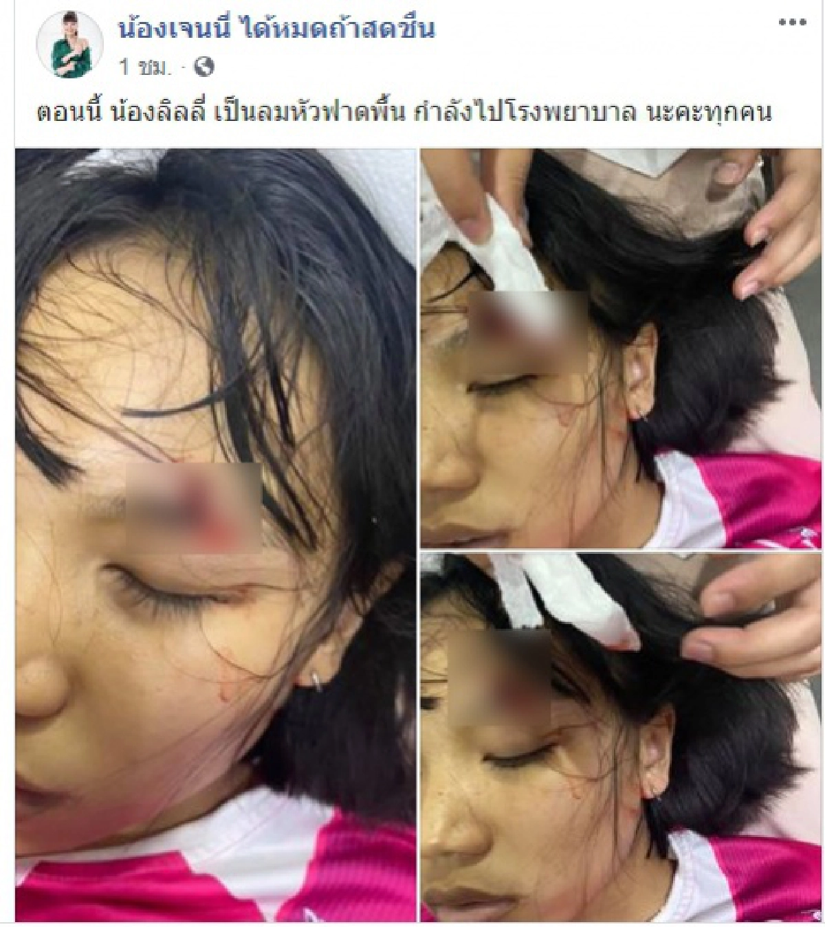น้องลิลลี่ได้หมดถ้าสดชื่น เป็นลมหัวฟาดพื้น ส่งรพ.ด่วน