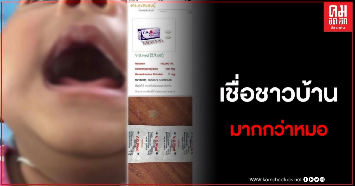 แม่เชื่อใช้ฉี่ป้ายปากลูก เชื้อราหาย พอหาหมอกลับสงสัยยาที่ให้ใช้ได้จริงหรอ แม่เชื่อใช้ฉี่ป้ายปากลูก เชื้อราหาย พอหาหมอกลับสงสัยยาที่ให้ใช้ได้จริงหรอ
