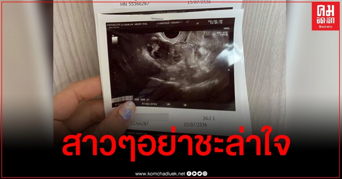 เตือนคุณผู้หญิง ประจำเดือนมาไม่ปกติอย่าชะล่าใจ อันตรายกว่าที่คิด