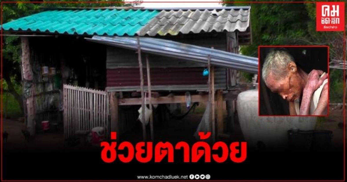 วอนช่วยเหลือ คุณตา 62 ปี ป่วยโรคสะเก็ดเงิน ถูกทิ้งให้อยู่ลำพังอาศัยเบี้ยชรายังชีพ วอนช่วยเหลือ คุณตา 62 ปี ป่วยโรคสะเก็ดเงิน ถูกทิ้งให้อยู่ลำพังอาศัยเบี้ยชรายังชีพ