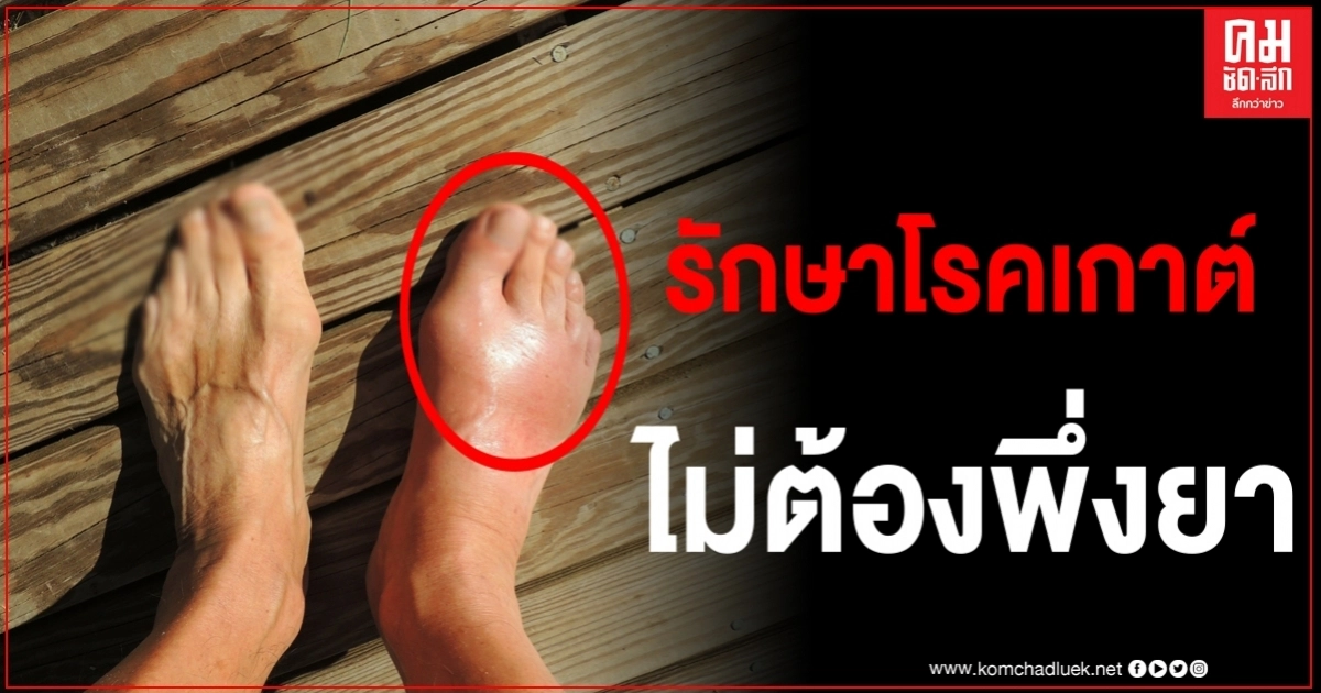 กรมการแพทย์เผย โรคเกาต์รักษาได้ด้วยวิธีง่ายๆ ไม่ต้องพึ่งยา กรมการแพทย์เผย โรคเกาต์รักษาได้ด้วยวิธีง่ายๆ ไม่ต้องพึ่งยา