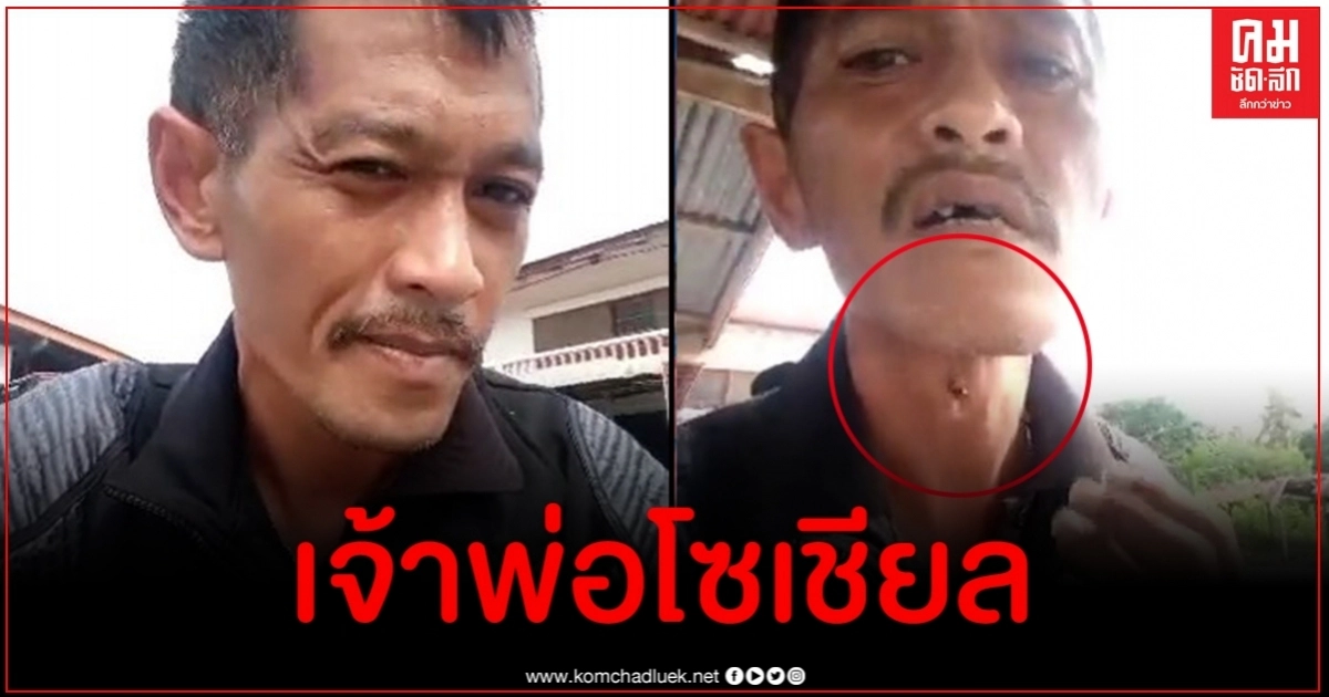 อู้ย ๆ ชาวเน็ตแซวหนุ่มสายโซเชียล เจอฝูงผึ้งต่อยหัวโนแต่ยังไม่หยุดไลฟ์สด อู้ย ๆ ชาวเน็ตแซวหนุ่มสายโซเชียล เจอฝูงผึ้งต่อยหัวโนแต่ยังไม่หยุดไลฟ์สด