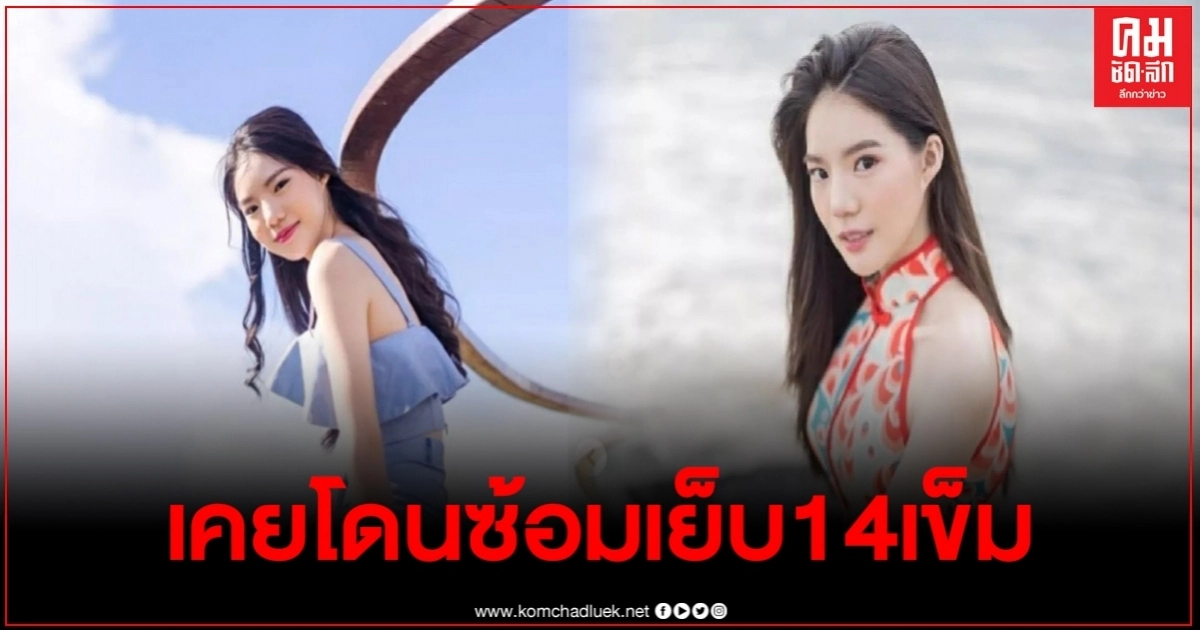 โดนแฉอีก อิงอิง เคยโดนซ้อมหนักจนเส้นเลือดฝอยในตาแตก-เย็บ14เข็ม โดนแฉอีก อิงอิง เคยโดนซ้อมหนักจนเส้นเลือดฝอยในตาแตก-เย็บ14เข็ม