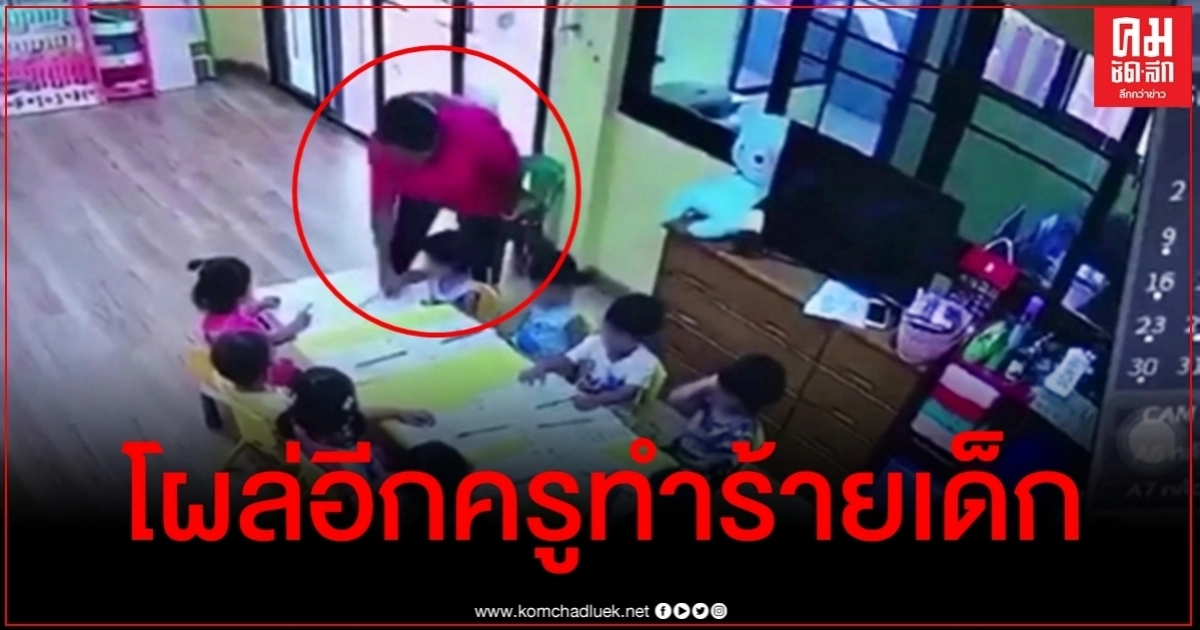 โผล่อีก ครูพี่เลี้ยงโรงเรียนเอกชนนครปฐม หยิกมือเด็ก 3 ขวบจนเป็นแผล โผล่อีก ครูพี่เลี้ยงโรงเรียนเอกชนนครปฐม หยิกมือเด็ก 3 ขวบจนเป็นแผล