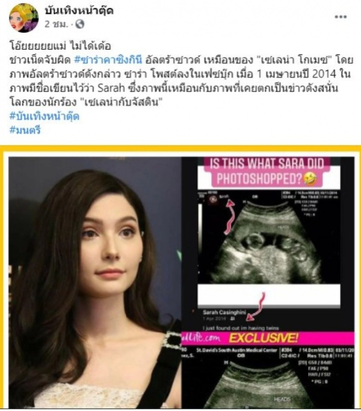 "ซาร่า" โดนเพจดังจับโป๊ะ แฉภาพอัลตราซาวด์ เหมือนของ "เซเลน่า โกเมซ" เป๊ะ