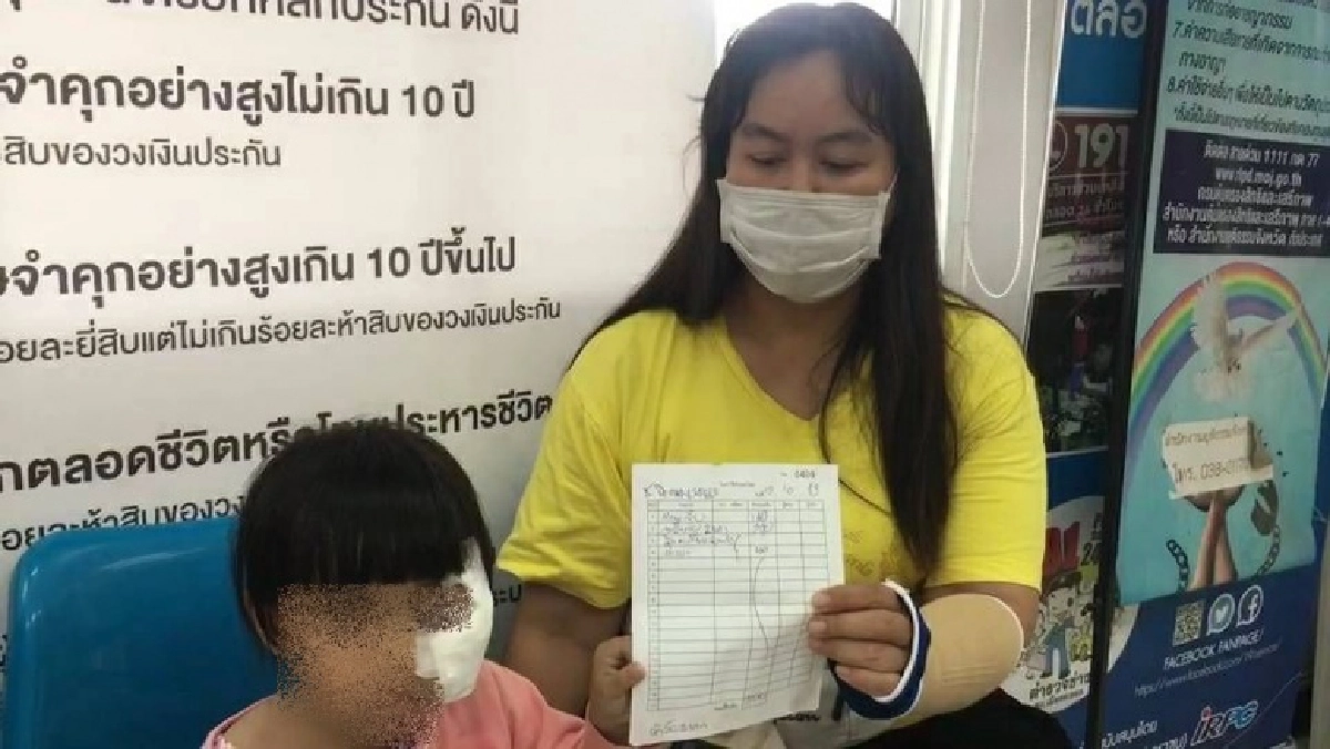 แม่ร้อง ผอ.ไม่รับผิดชอบไล่หมาวิ่งตัดหน้ารถ เล่านาทีปวดใจลูกน้อยหน้ากระแทกเย็บ 16 เข็ม