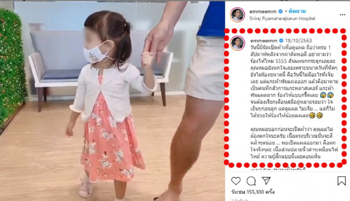 "เอ็ม บุษราคัม" เผยวินาทีหมอแกะแผลน้อง "นาฬิกา" ออก ตกใจมาก เนื้อตรงนั้นกลายเป็นสีดำ