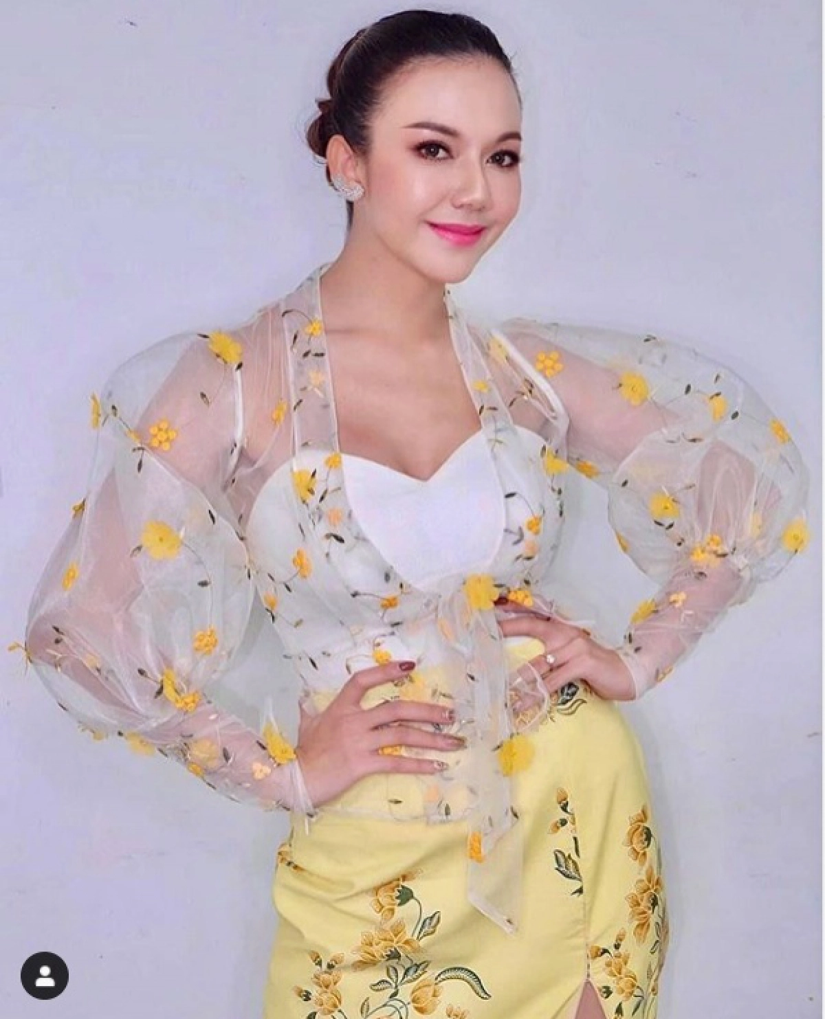 สุดใจบุญ "จ๊ะ อาร์สยาม" ขอช่วยค่ารักษา น้องหมอก สุนัขผู้ซื่อสัตย์