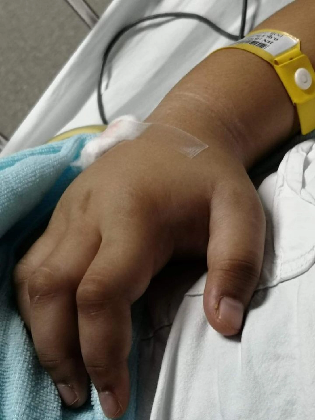 แม่เล่าอุทาหรณ์เกือบสูญเสียลูก ฉะหมอตรวจผ่านๆบอกอาหารเป็นพิษทั้งที่ไส้ติ่งแตก