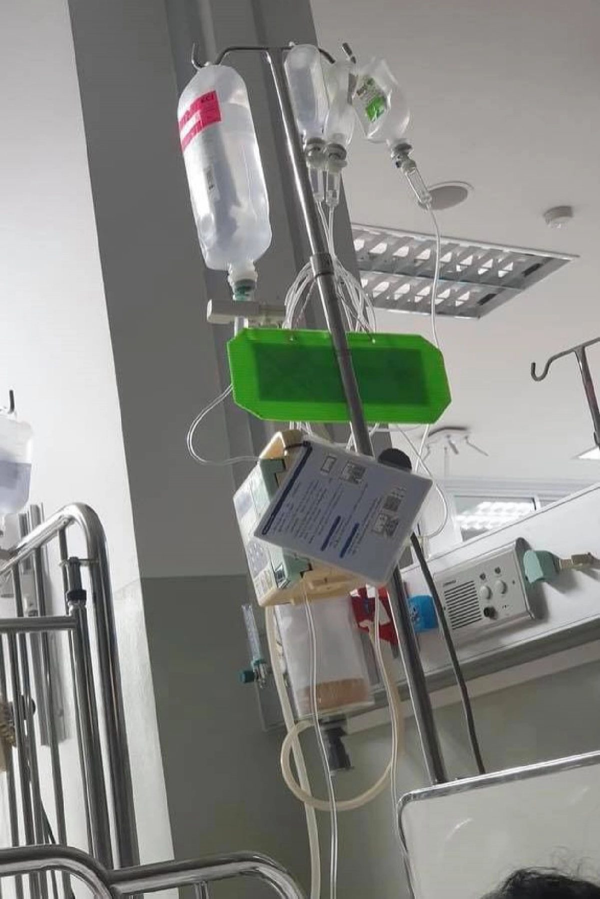 แม่เล่าอุทาหรณ์เกือบสูญเสียลูก ฉะหมอตรวจผ่านๆบอกอาหารเป็นพิษทั้งที่ไส้ติ่งแตก