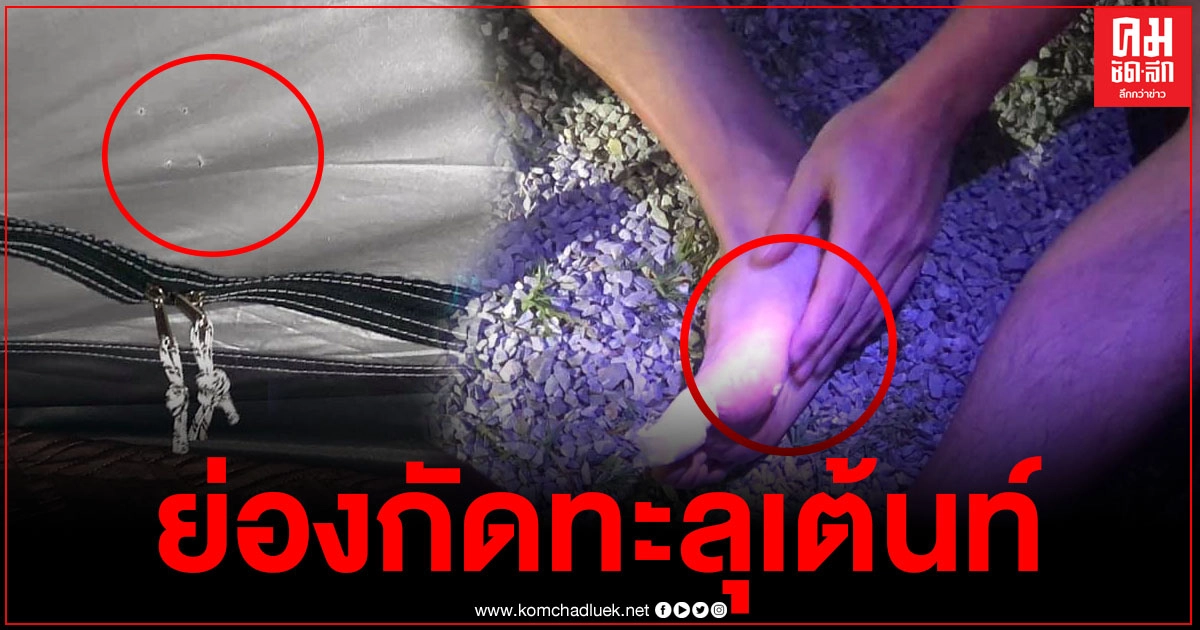 หนุ่มเล่าประสบการณ์สยอง นอนกางเต้นท์อยู่ดีดี ถูกกัดทะลุเท้า 4 รู เลือดสาด จนเช้ามารู้ความจริงไม่อยากจะเชื่อเลย หนุ่มเล่าประสบการณ์สยอง นอนกางเต้นท์อยู่ดีดี ถูกกัดทะลุเท้า 4 รู เลือดสาด จนเช้ามารู้ความจริงไม่อยากจะเชื่อเลย