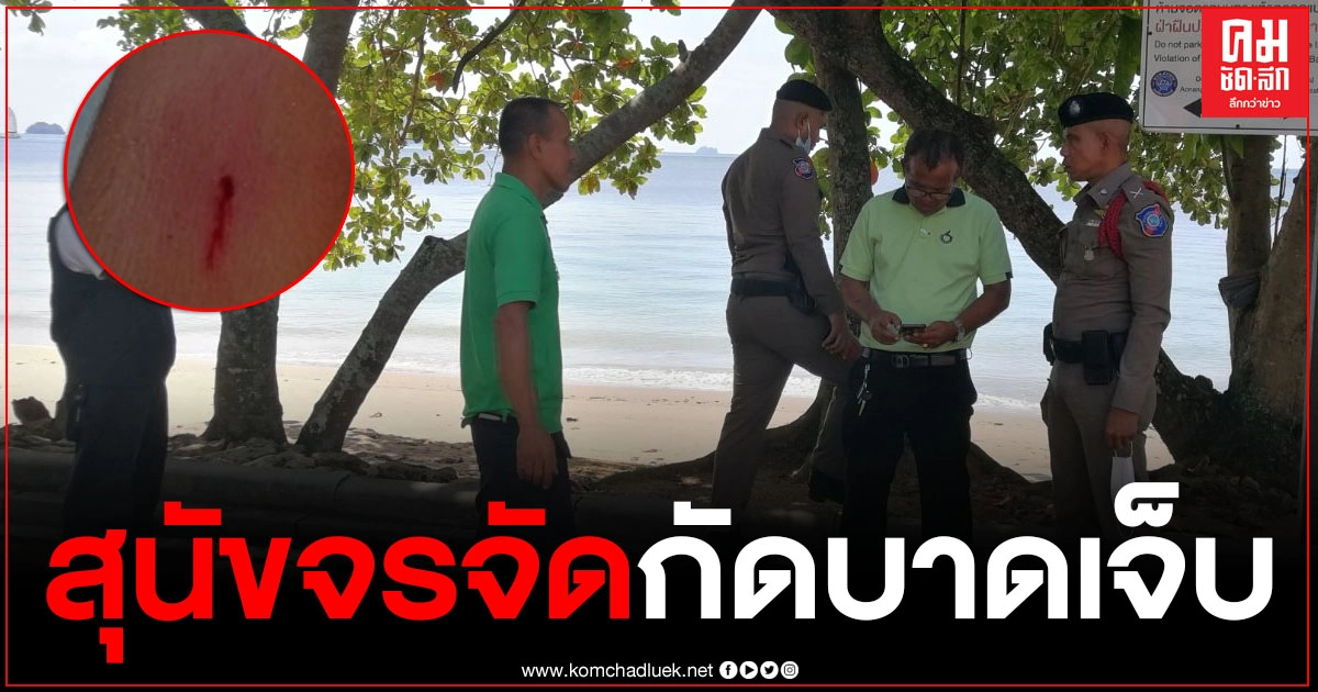 เคราะห์ร้าย สุนัขจรจัดหาดอ่าวนาง ขย้ำฝังเขี้ยวที่น่อง เด็กชายต่างชาติวัย 8 ขวบ เจ็บ เคราะห์ร้าย สุนัขจรจัดหาดอ่าวนาง ขย้ำฝังเขี้ยวที่น่อง เด็กชายต่างชาติวัย 8 ขวบ เจ็บ