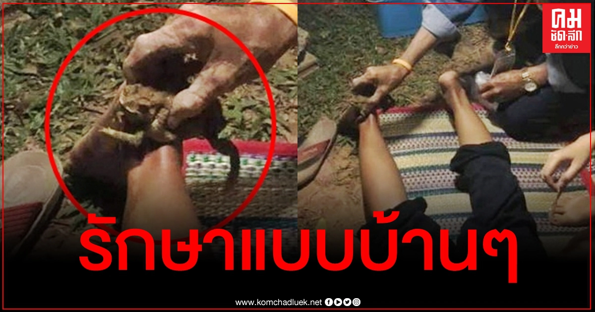 ฉันร้องกรี๊ดเลย "หมอแล็บ" เตือนอย่าหาทำ เอาคางคกมาดูดพิษตะขาบ