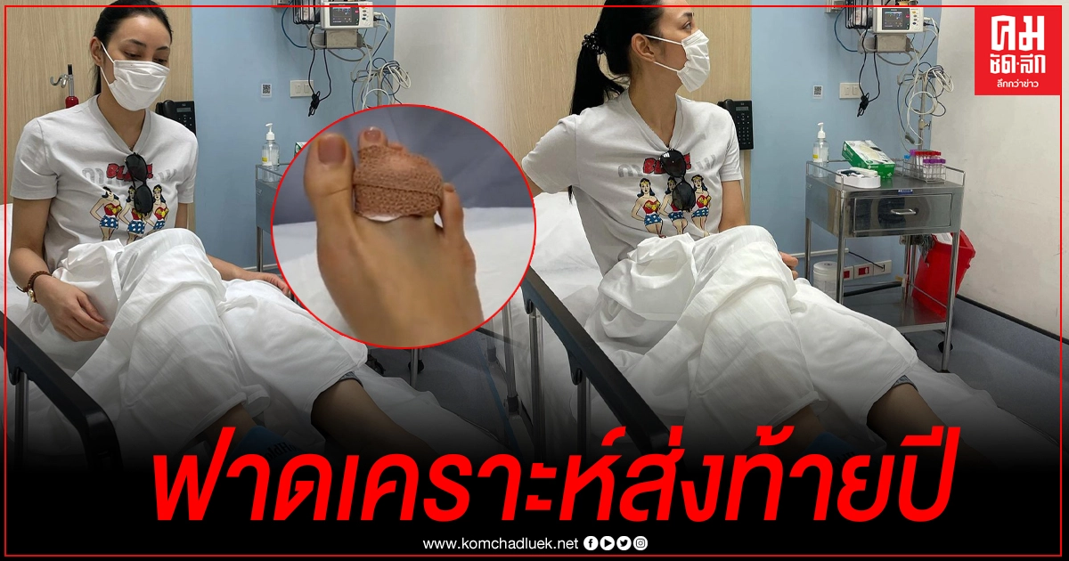"ตั๊ก บงกช" นิ้วเท้าหัก ฟาดเคราะห์เจ็บตัวส่งท้ายปี 