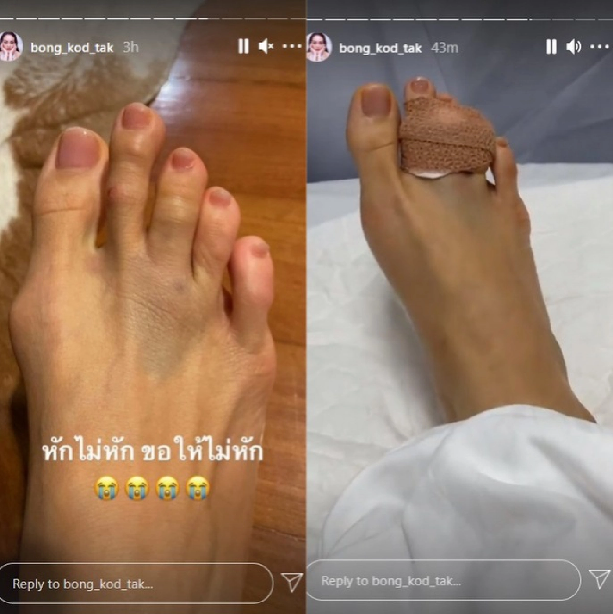 "ตั๊ก บงกช" นิ้วเท้าหัก ฟาดเคราะห์เจ็บตัวส่งท้ายปี 