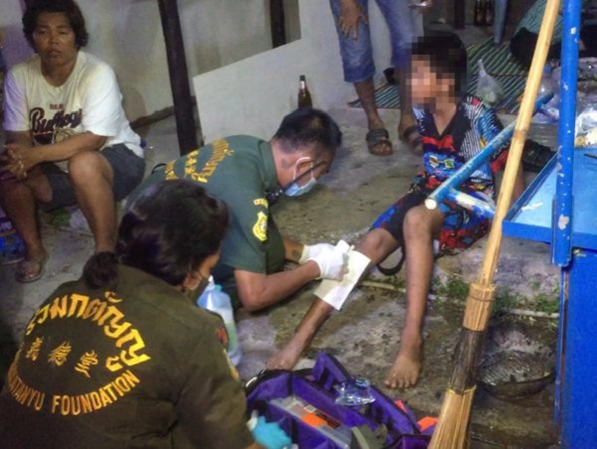 อีกแล้ว ตะแกรงเหล็กฝาท่อชำรุด ด.ช.วัย 12 พลัดตกถูกบาดขาต้องเย็บเกือบ 10 เข็ม