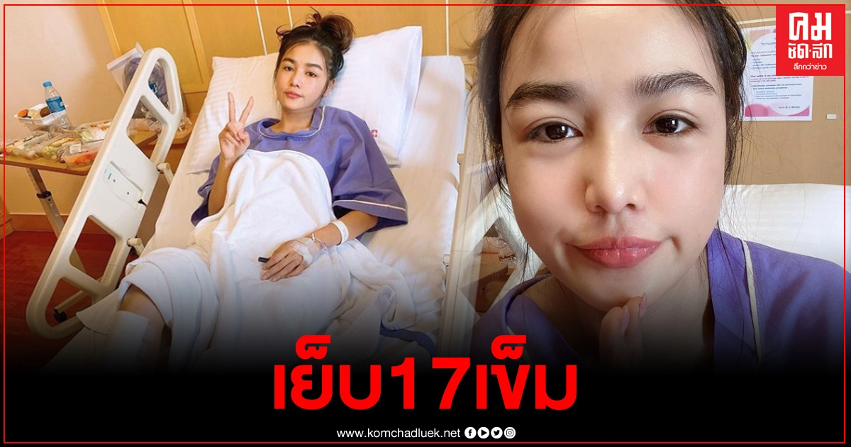 "กระแต อาร์สยาม" อัปเดตอาการล่าสุด หลังลื่นล้มขาฟาดขอบสระ "กระแต อาร์สยาม" อัปเดตอาการล่าสุด หลังลื่นล้มขาฟาดขอบสระ