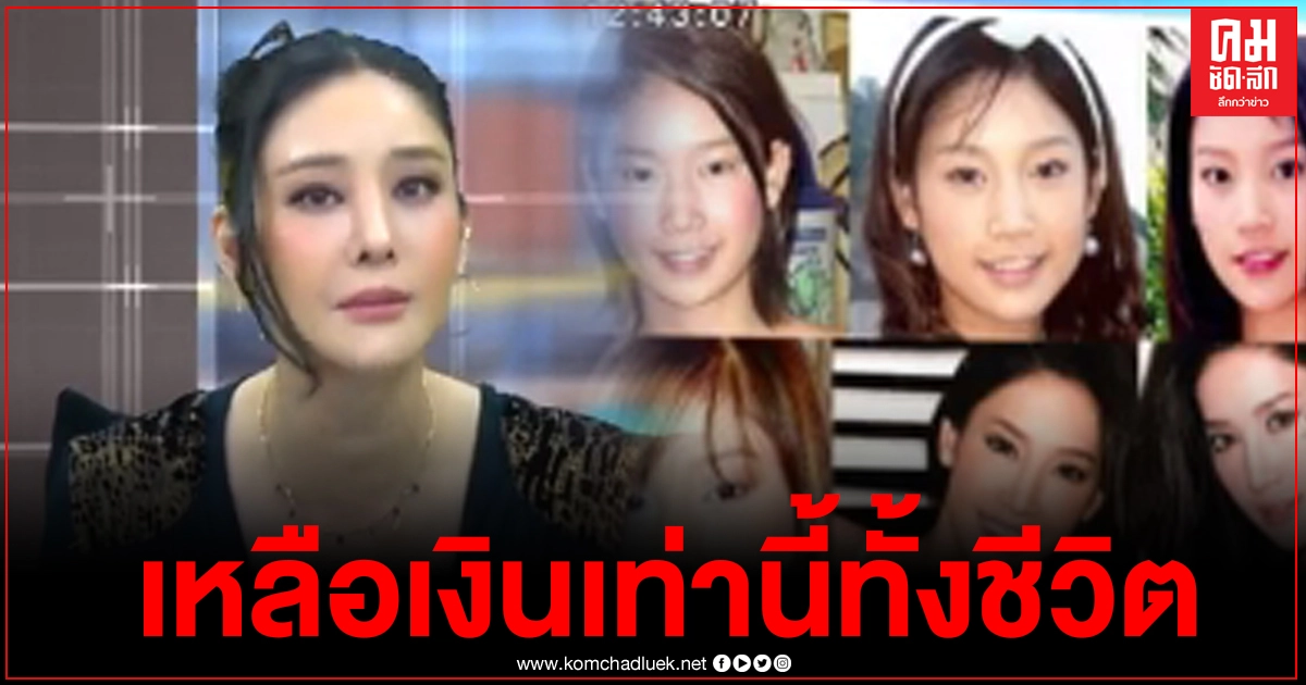 "แตงโม นิดา"เปิดใจมรสุมชีวิตปากเบี้ยวเพราะศัลยกรรม เป็นหนี้ 10 ล้าน "แตงโม นิดา"เปิดใจมรสุมชีวิตปากเบี้ยวเพราะศัลยกรรม เป็นหนี้ 10 ล้าน