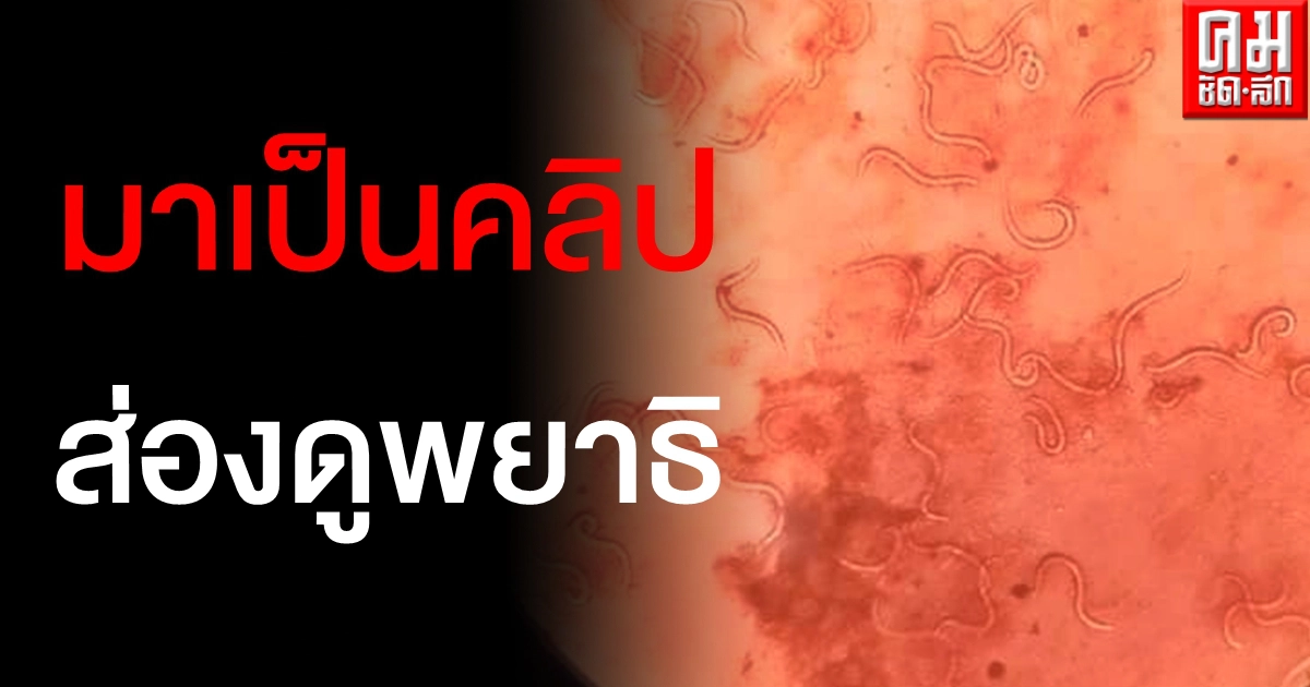 มาเป็นคลิป "พยาธิสตรองจิลอยด์" เมื่อส่องด้วยกล้องจุลทรรศน์ มาเป็นคลิป "พยาธิสตรองจิลอยด์" เมื่อส่องด้วยกล้องจุลทรรศน์