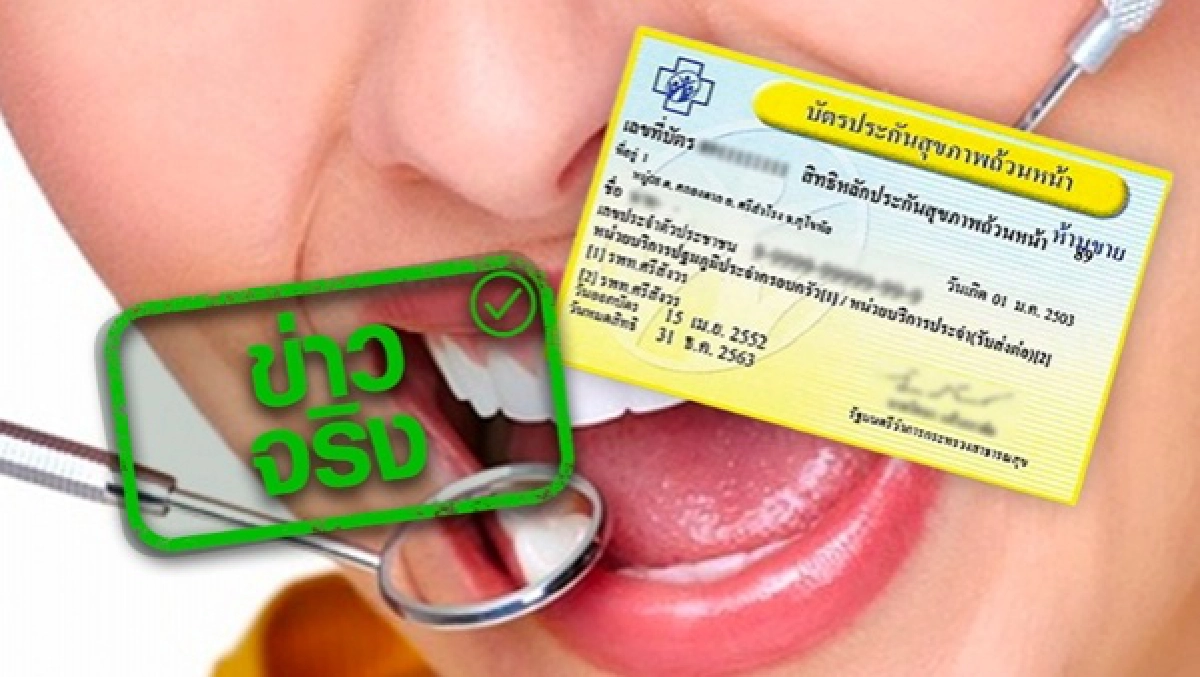 สิทธิประโยชน์บัตรทอง