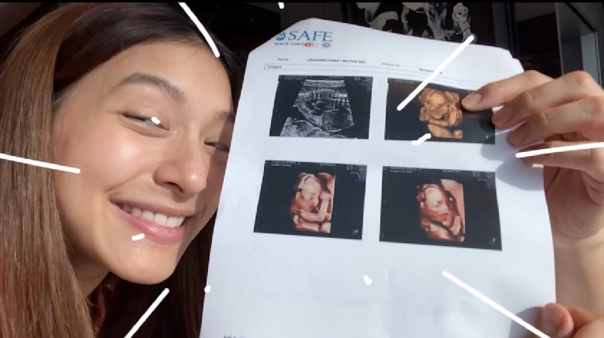 "มิว นิษฐา" เฉลยเพศลูกในท้อง "เซนต์" ลุ้นให้ลูกหน้าเหมือนแม่