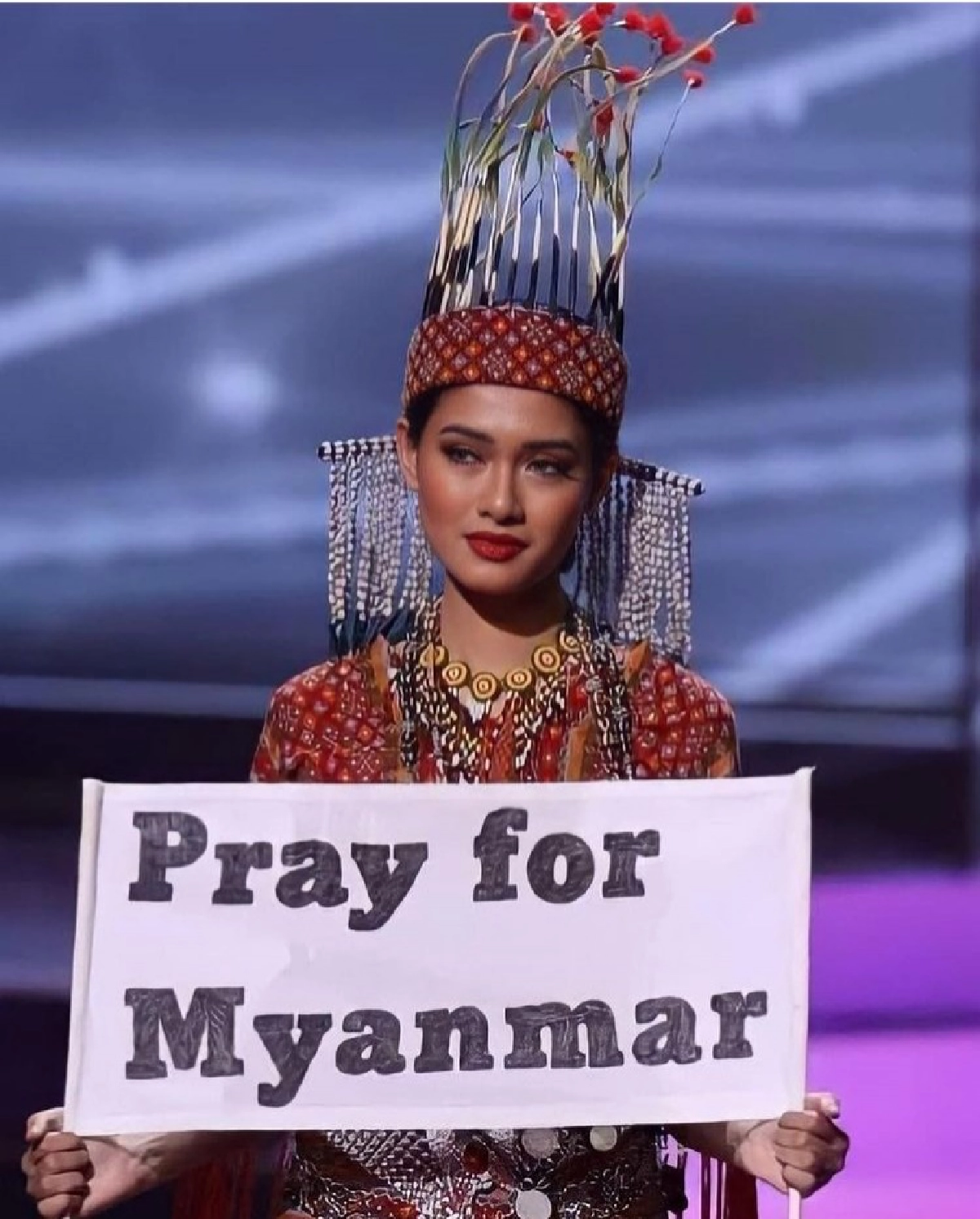 ไม่อาย "Thuzar Wint Lwin" มิสยูนิเวิร์สพม่า 2020 เปิดรอยแผลจากการผ่าตัด