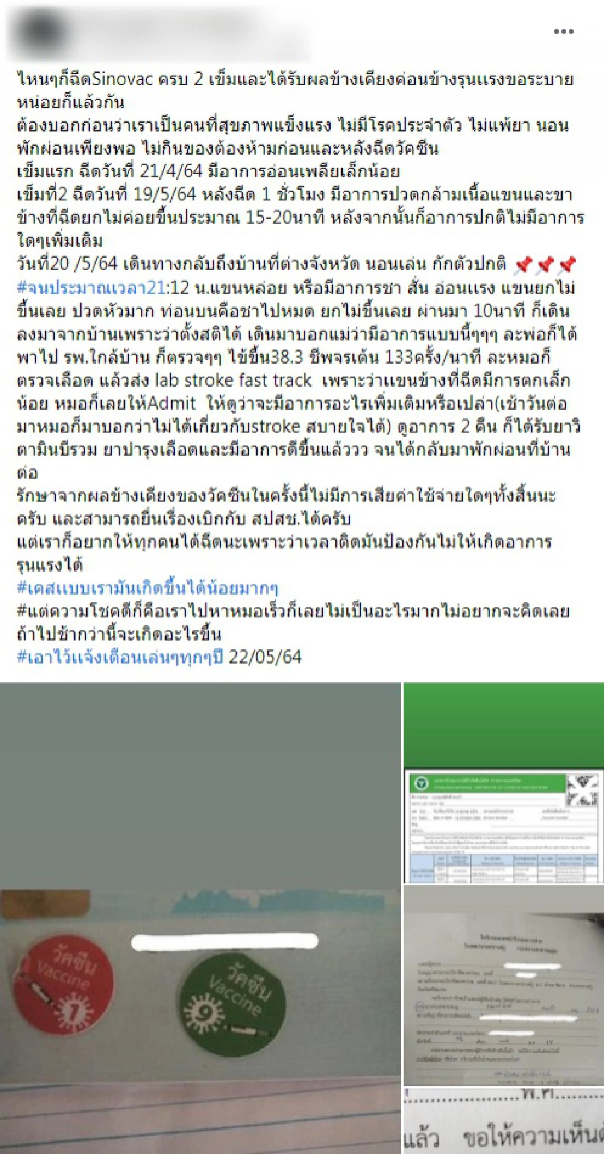 หนุ่มรีวิวแพ้วัคซีนซิโนแวคหลังฉีดครบ 2 เข็ม เคสเเบบนี้เกิดขึ้นได้น้อยมากๆ