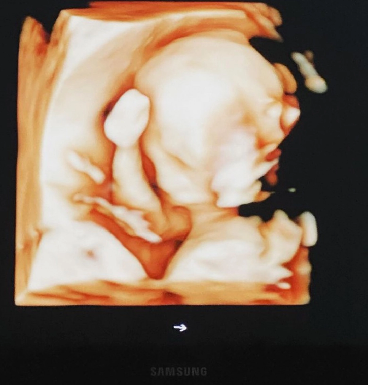  "หยาด" โชว์คลิปอัลตร้าซาวด์ลูกน้อย  รู้แล้วเพศไหนแต่อยากให้ลุ้น