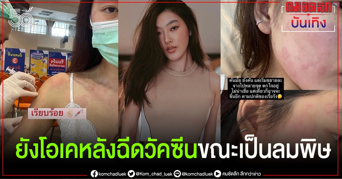 'สกุล กัญญาภัค' ยังโอเคหลังฉีดวัคซีนขณะเป็นลมพิษ และมีโรคประจำตัวลิ้นหัวใจรั่ว ภูมิแพ้ ไมเกรน 'สกุล กัญญาภัค' ยังโอเคหลังฉีดวัคซีนขณะเป็นลมพิษ และมีโรคประจำตัวลิ้นหัวใจรั่ว ภูมิแพ้ ไมเกรน