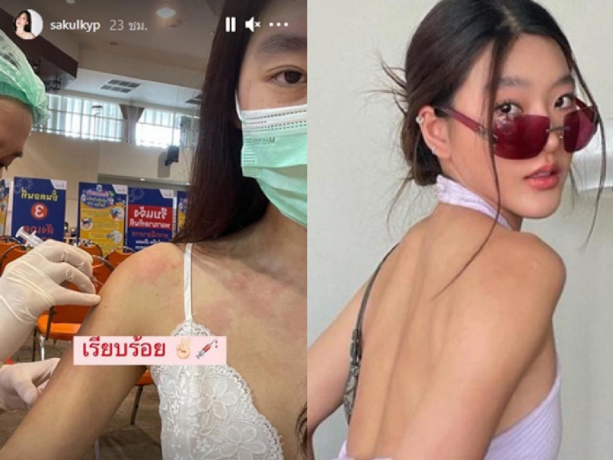 'สกุล กัญญาภัค'  ยังโอเคหลังฉีดวัคซีนขณะเป็นลมพิษ และมีโรคประจำตัวลิ้นหัวใจรั่ว ภูมิแพ้ ไมเกรน
