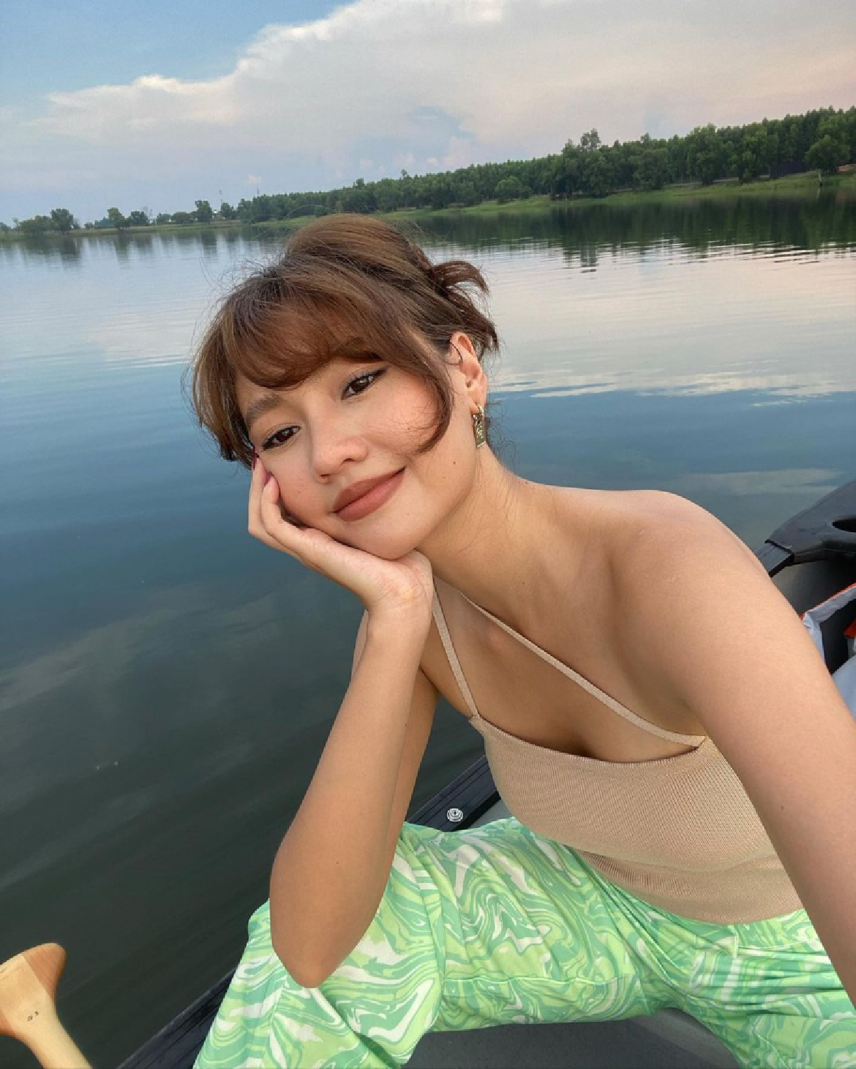 เกิดอะไรขึ้น\"เมทัล สุขขาว\"ภรรยา\"โดม\"เปิดที่มาแผลเป็น
