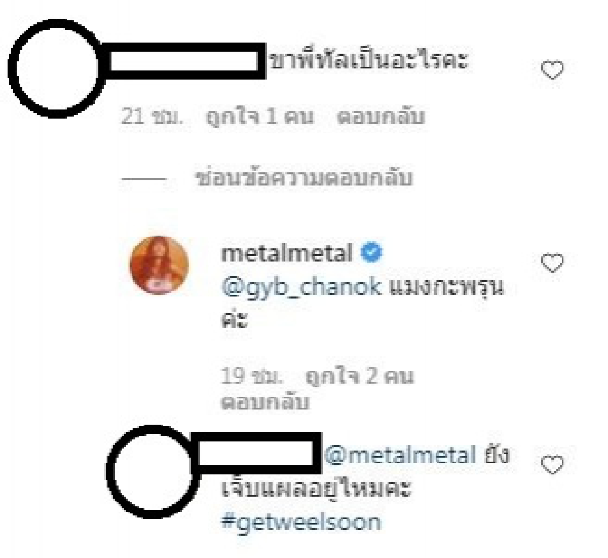 เกิดอะไรขึ้น\"เมทัล สุขขาว\"ภรรยา\"โดม\"เปิดที่มาแผลเป็น