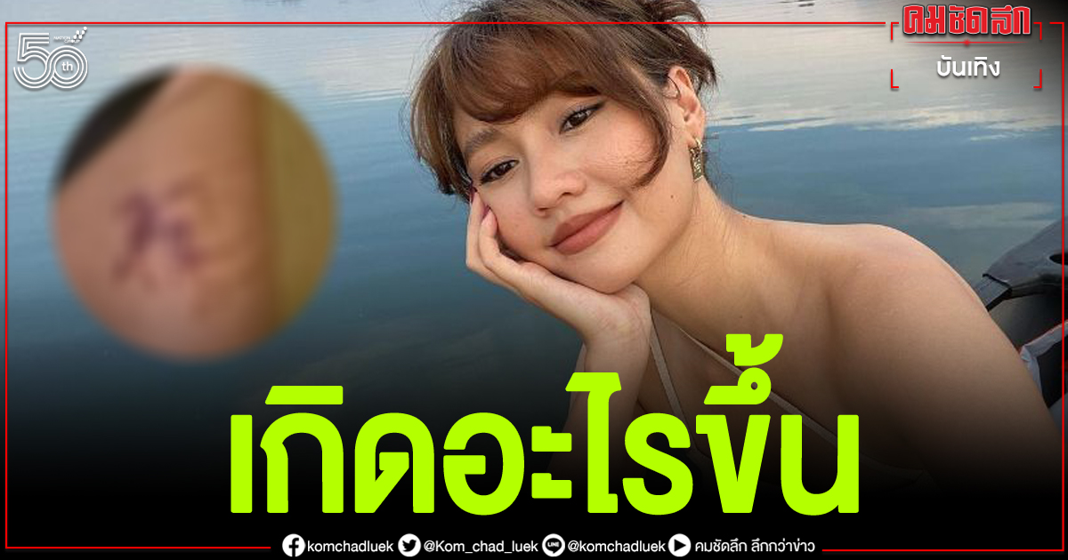 เกิดอะไรขึ้น"เมทัล สุขขาว"ภรรยา"โดม"เปิดที่มาแผลเป็น เกิดอะไรขึ้น"เมทัล สุขขาว"ภรรยา"โดม"เปิดที่มาแผลเป็น