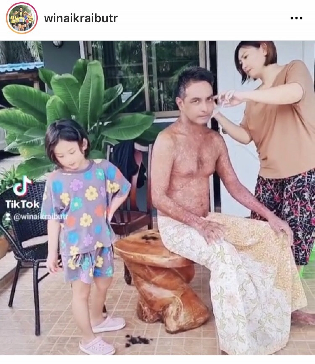 "วินัย ไกรบุตร" ยังยิ้มได้ แม้โรคตุ่มน้ำพองกำเริบ มีเมีย-ลูก เป็นกำลังใจ