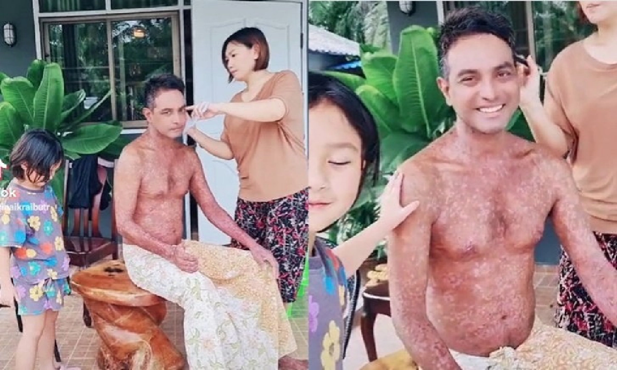 "วินัย ไกรบุตร" ยังยิ้มได้ แม้โรคตุ่มน้ำพองกำเริบ มีเมีย-ลูก เป็นกำลังใจ