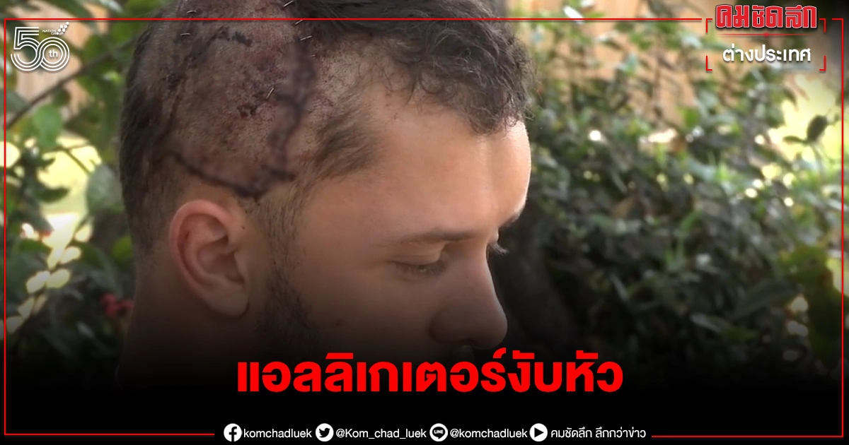 "ผมอยู่ในปากของมัน" หนุ่มฟลอริดาเล่านาทีถูกแอลลิเกเตอร์โจมตีในแม่น้ำ "ผมอยู่ในปากของมัน" หนุ่มฟลอริดาเล่านาทีถูกแอลลิเกเตอร์โจมตีในแม่น้ำ