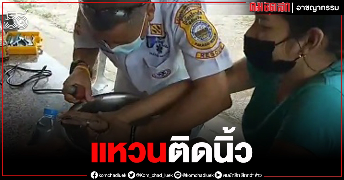 อุทาหรณ์ สาวชอบสวมแหวน สุดท้ายนิ้วบวม ถอดไม่ได้ อุทาหรณ์ สาวชอบสวมแหวน สุดท้ายนิ้วบวม ถอดไม่ได้