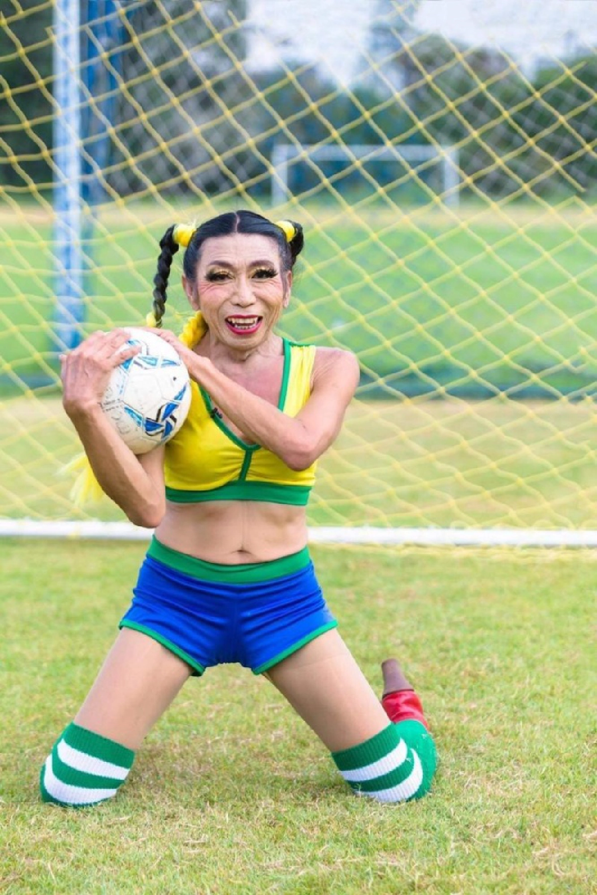 "สิตางศุ์ บัวทอง" เผยใบหน้าหลังศัลยกรรม 3 วัน โชว์หวาน สามีดูแลอย่างดี