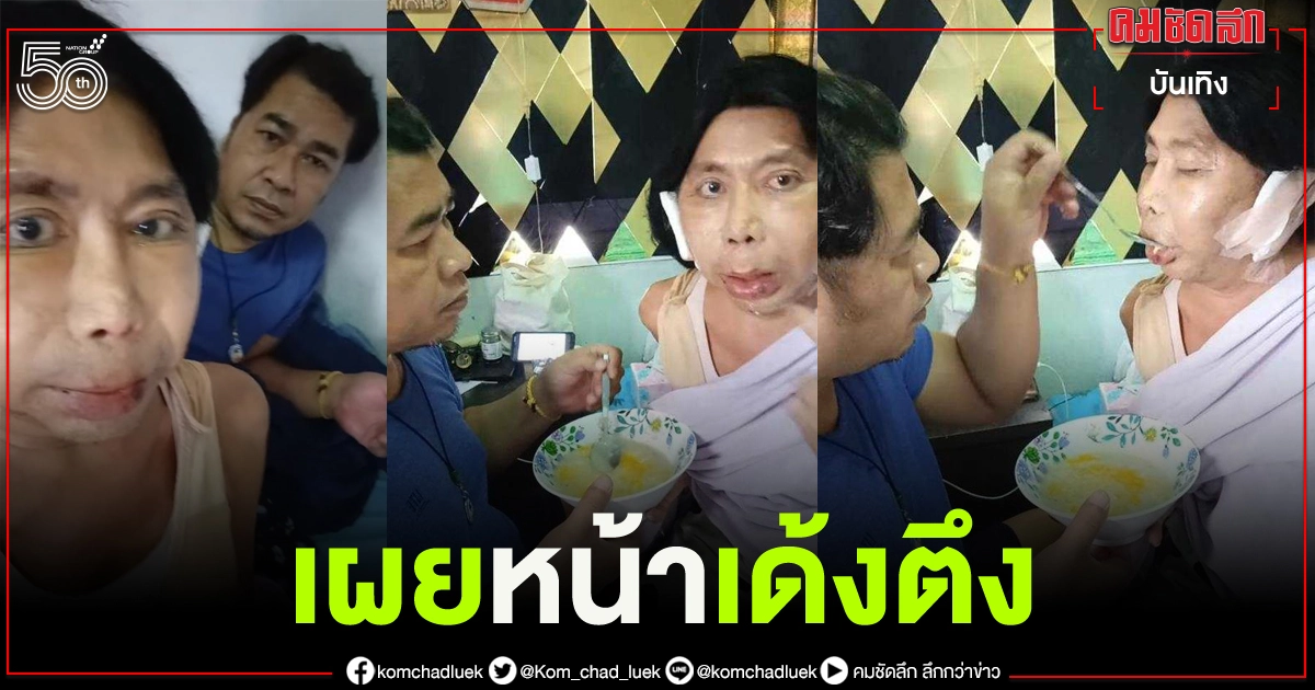"สิตางศุ์ บัวทอง" เผยใบหน้าหลังศัลยกรรม 3 วัน โชว์หวาน สามีดูแลอย่างดี